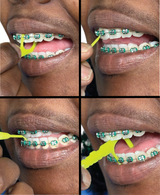 Braces Toothbrush Rechargeable With 4 Heads Bonus 2